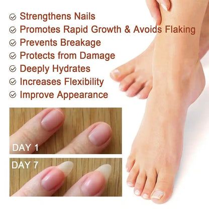 SÉRUM GELM - ELIMINADOR DE HONGOS EN UÑAS Y PIEL